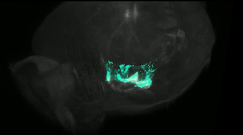 cerebro transparente