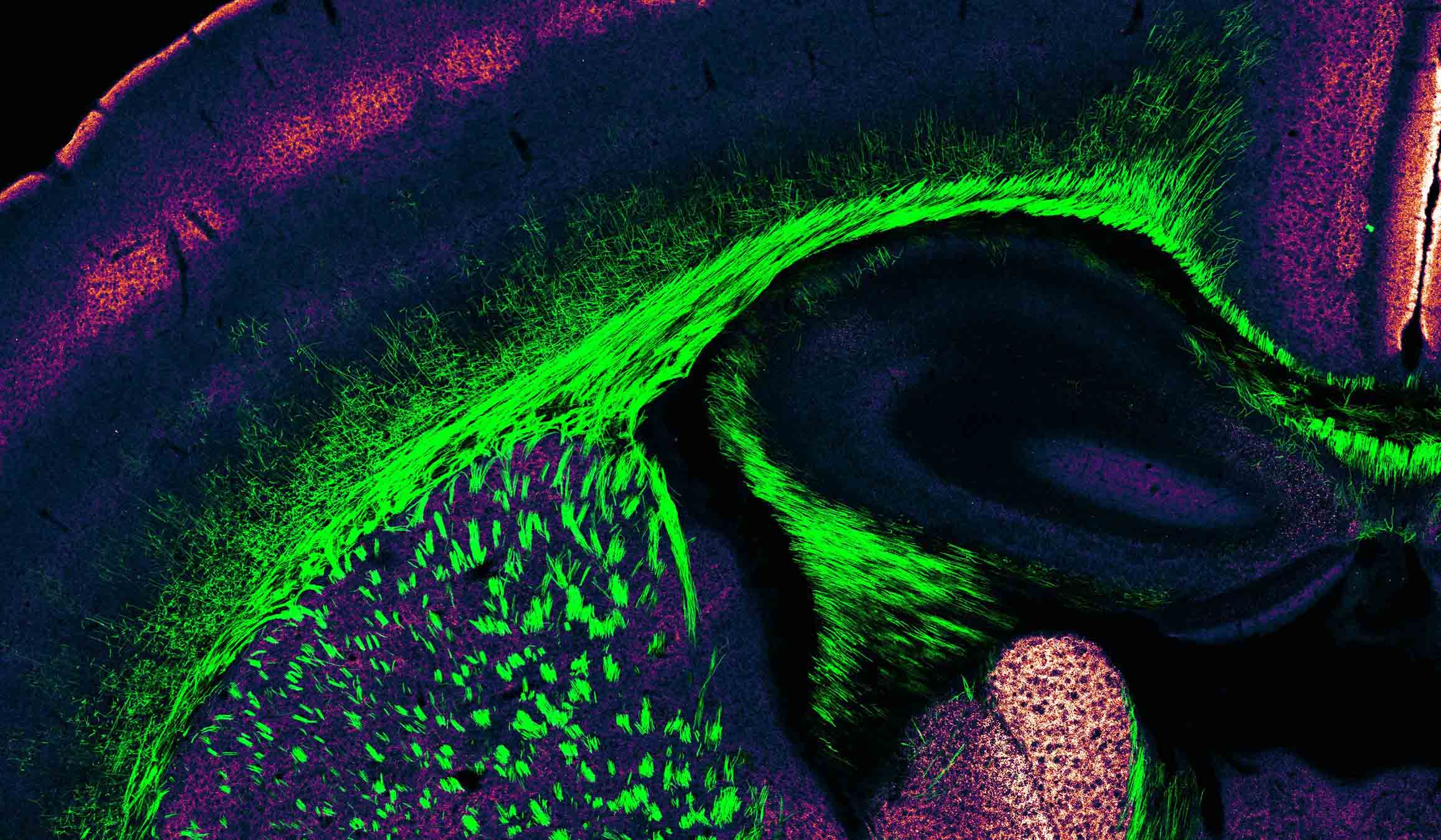 Modulación Sináptica De Los Circuitos Neuronales Y La Conducta ...